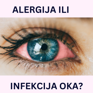 alergijski konjunktivitis